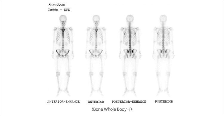 Bone Whole Body-1