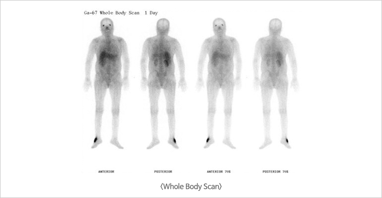Whole Body Scan