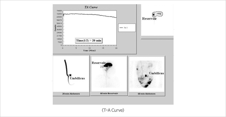 T-A Curve