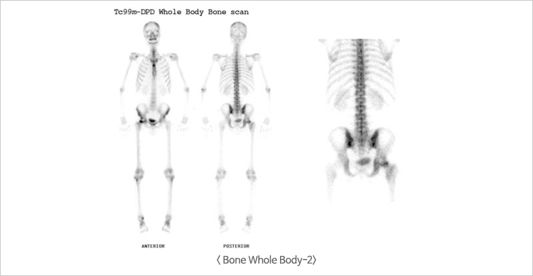 Bone Whole Body-2