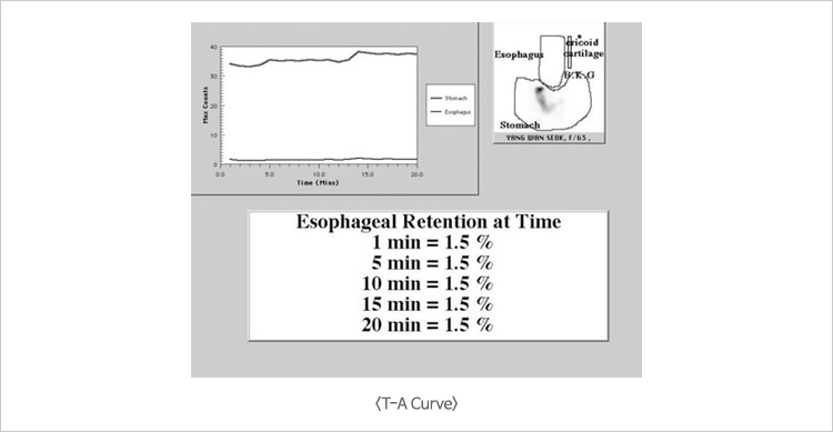 T-A Curve