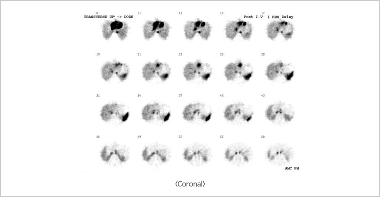 Coronal