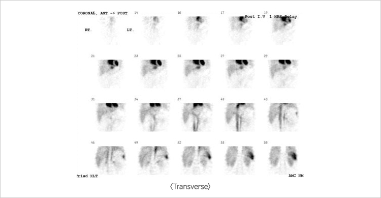 Transverse