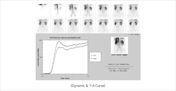 Dynamic & T-A Curve