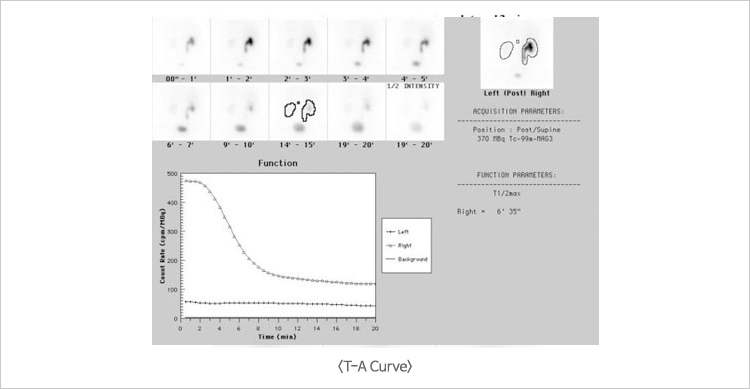 T-A Curve