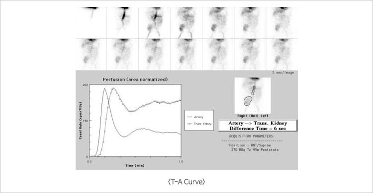 T-A Curve