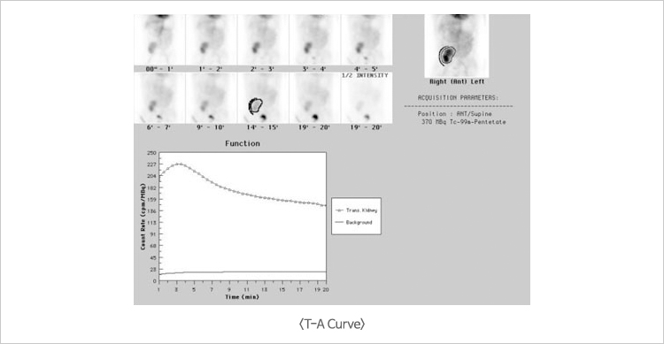 T-A Curve