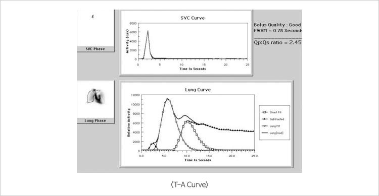 T-A Curve