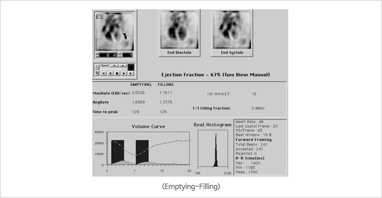 Emptying-Filling