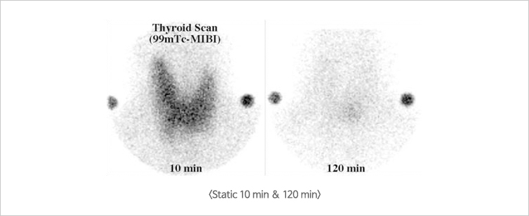 Static 10 min & 120 min