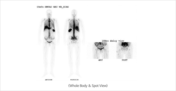 Whole Body & Spot View